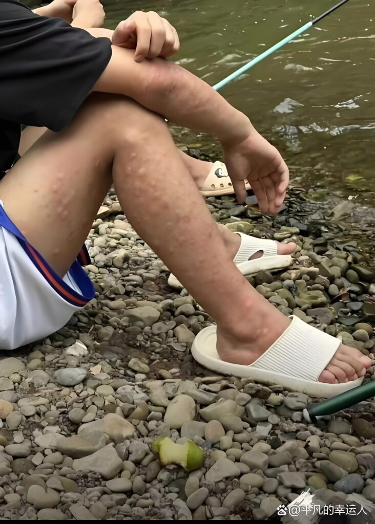 钓鱼防虫知识